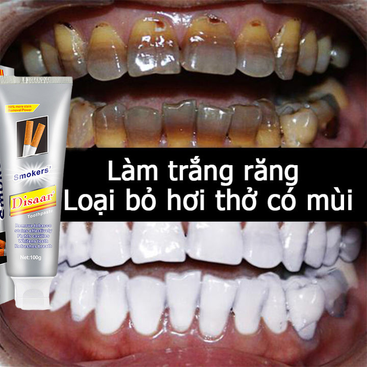 【Vận chuyển siêu nhanh】Kem Đánh Răng Disaar Thái Lan Tẩy Ố Vàng Răng, Làm Trắng Răng, làm hết Hôi Miệng, Răng Vàng，hiệu quả nhanh, miệng thơm mát sảng khoái.