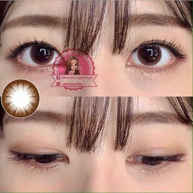 lens choco giản to sử dụng 1 năm tặng kèm khây đựng