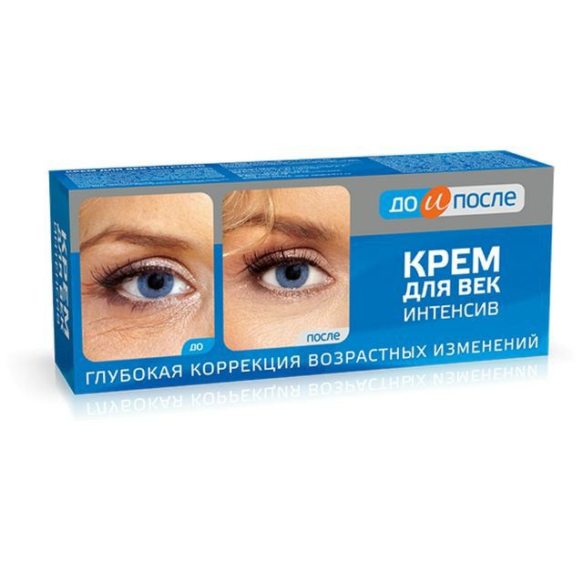 Kem dưỡng da chống nhăn vùng mắt Kpem của Nga