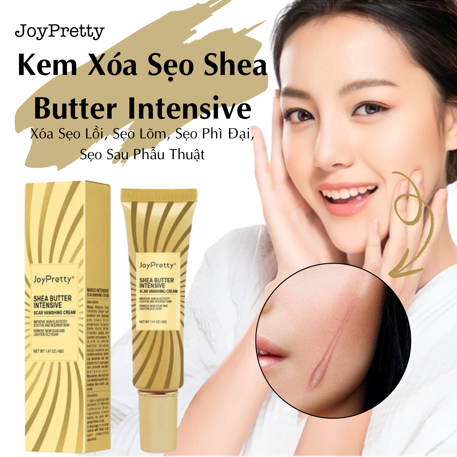Kem xóa sẹo shea butter intensive xóa sẹo lồi, sẹo lõm, sẹo phì đại, sẹo sau phẫu thuật, làm mềm da, thúc đẩy tái tạo làn da mới