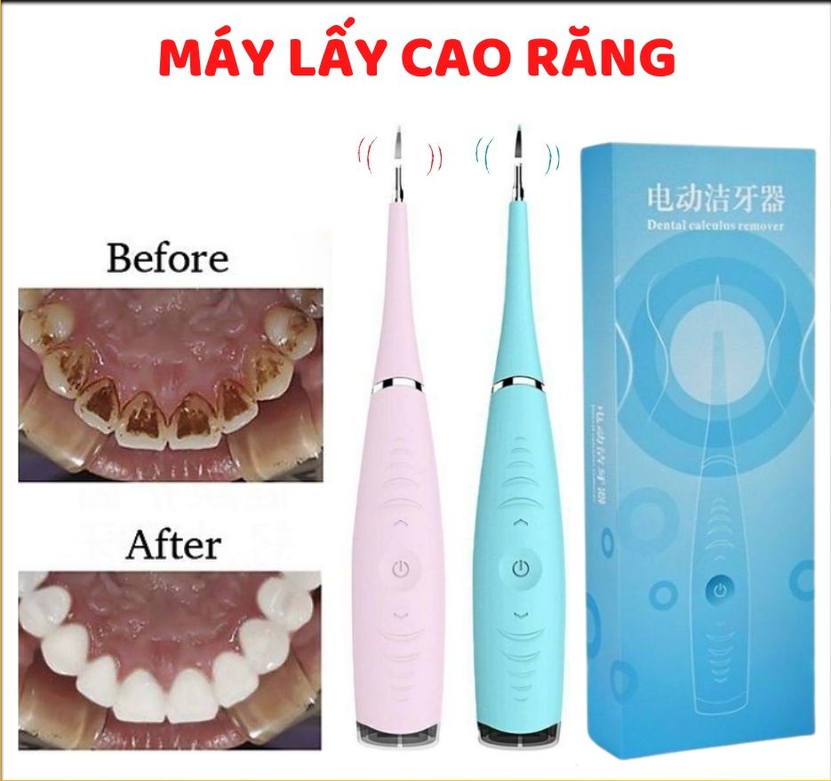 Dụng cụ lấy cao răng - thiết bị vệ sinh răng miệng tại nhà
