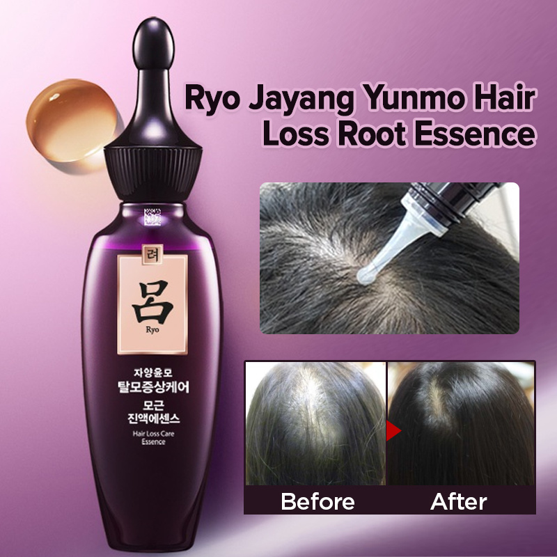 Tinh chất dưỡng ngăn ngừa rụng tóc Ryo Hair Loss Care Essence