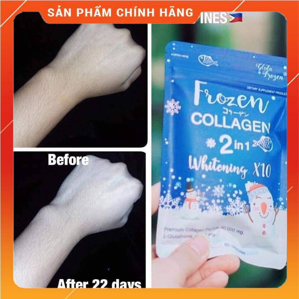 Viên trắngda frozen collagen 2in1 whitening x10 gói 60v thái lan trắng sáng da ,mờ thâm mụn , nám , sẹo , cấp ẩm cho da