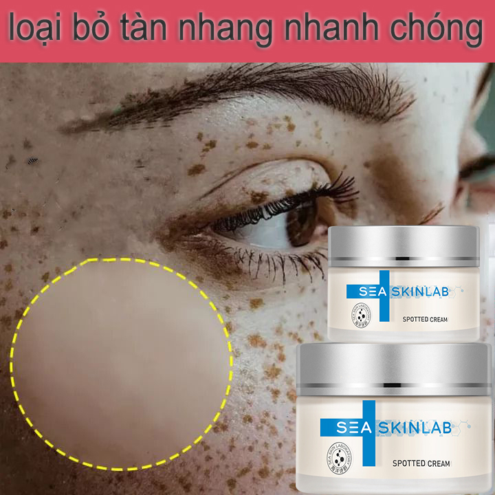 (Kem Làm Trắng)làm mờ hắc tố Ẩm Làm Sáng Da Làm mờ tàn nhang hiệu quả làm giảm vết nám, tàn nhang, làm mờ da xỉn màu nếp nhăn vùng mắt, vết chân chim