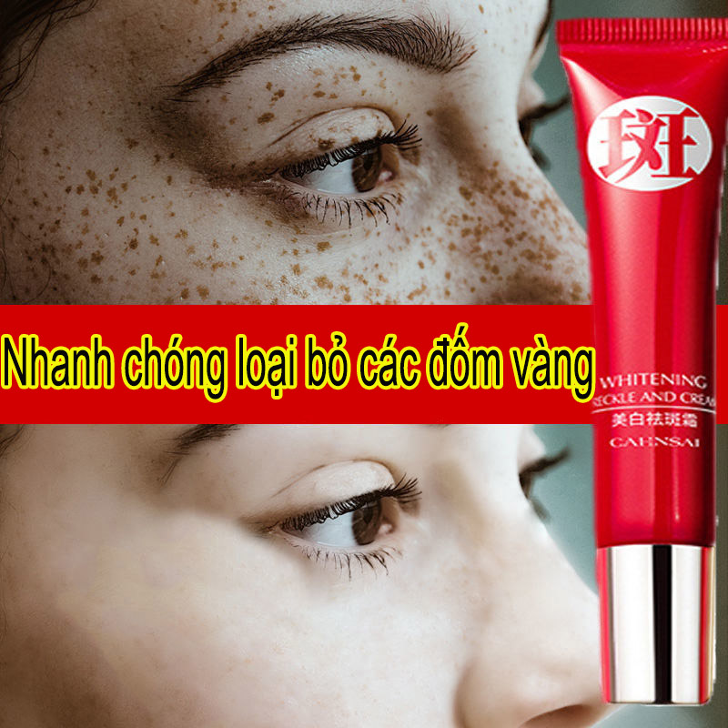 Kem dưỡng trắng và xóa tàn nhang, phân hủy melanin, ức chế tái tạo tại chỗ, kem làm trắng và loại bỏ tàn nhang 20g, ức chế tiêu diệt mạnh mẽ các hắc tố, vết thâm, nám, dưỡng ẩm, làm sáng màu da, chăm sóc da