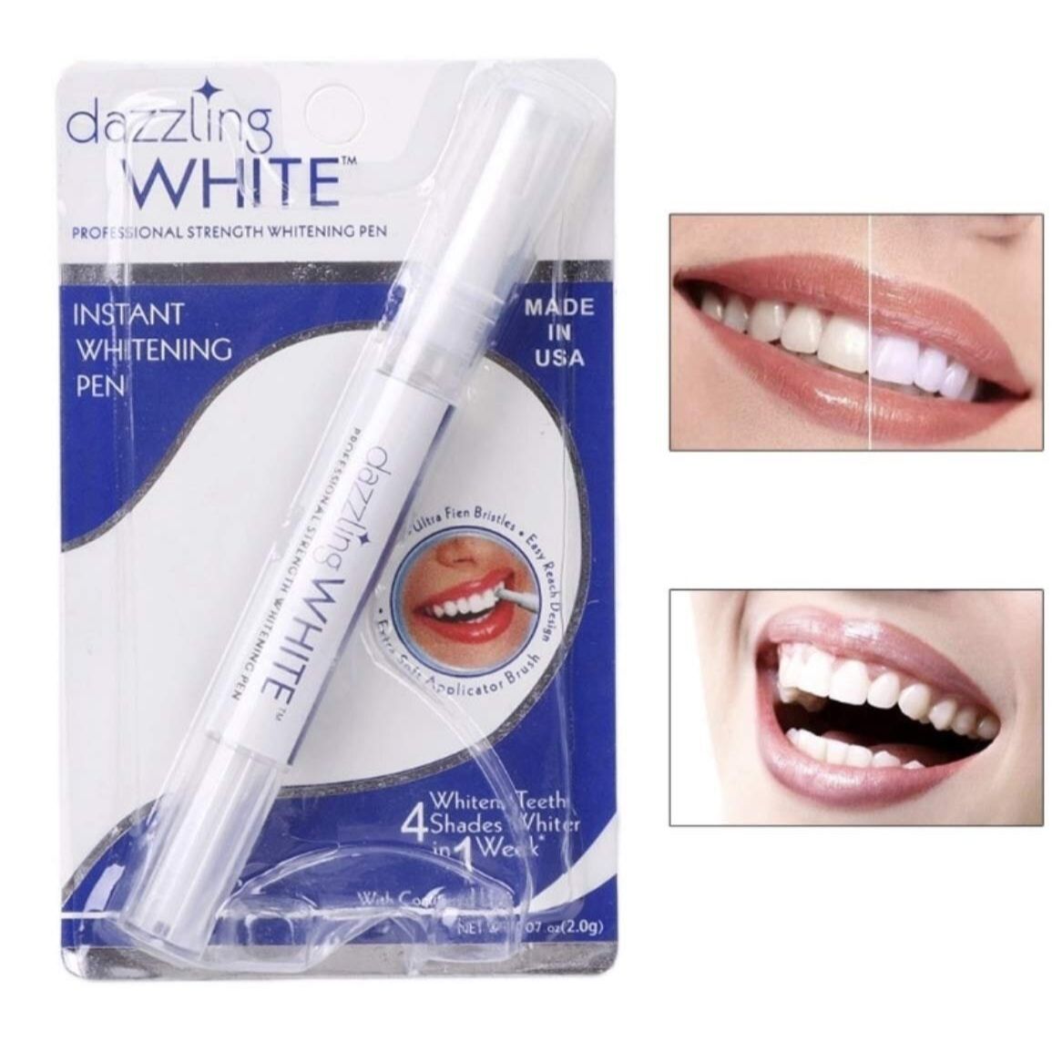 Bút trắng răng dazzling White