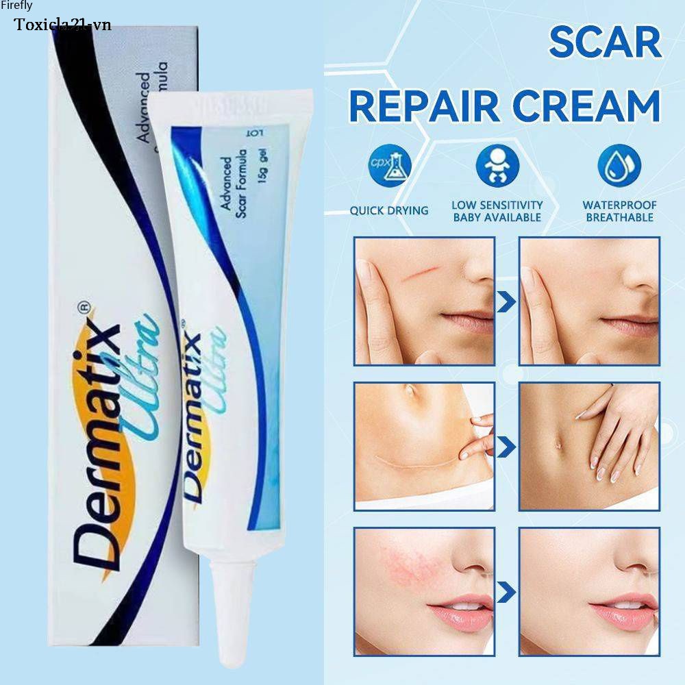 Dermatix Scar Gel Trị Sẹo Thâm Điều Trị Sẹo Mụn Cũ Loại Bỏ Sẹo Hiệu Quả Nhập Khẩu Loại bỏ vết rạn da Kem dưỡng trắng da 祛疤霜15g