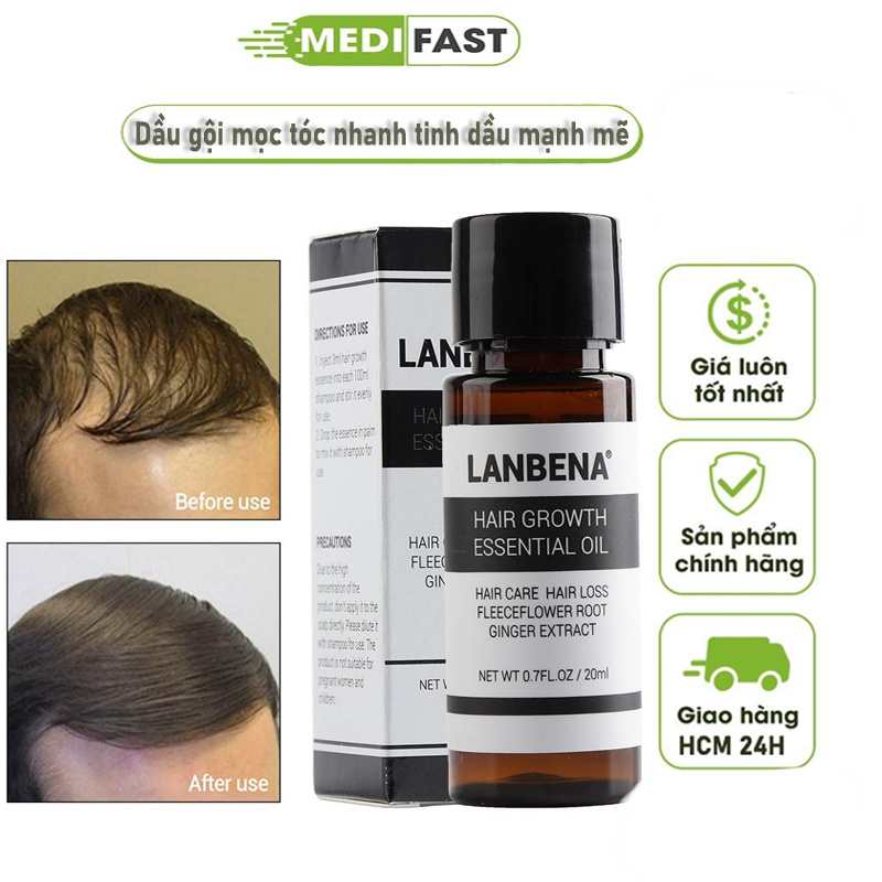 Tinh chất kích mọc tóc lanebna hỗ trợ kích thích tinh dầu mọc tóc hiệu quả ngăn rụng tóc 20ml