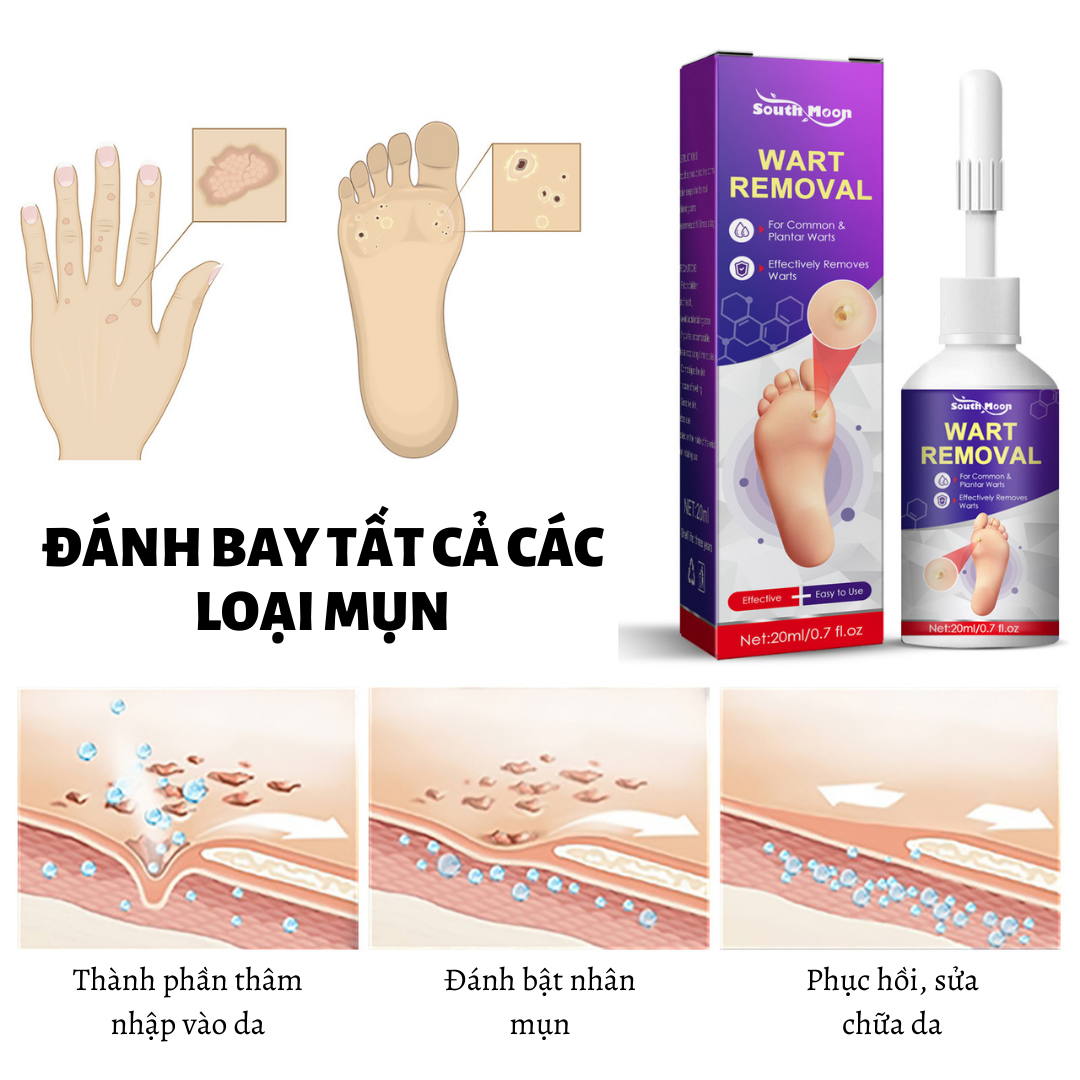 Dung dịch tẩy nốt ruồi loại bỏ mụn cơm mụn cóc nốt ruồi trên mặt/ tàn nhang/ mụn cơm/ đốm đen hắc tố không để lại sẹo 20g Dung dịch loại bỏ dứt điểm và vĩnh viễn - Tận gốc mụn cóc