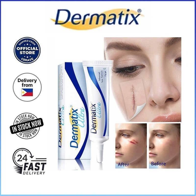 COD Dermatix Ultra Gel 15g Công thức loại bỏ sẹo nâng cao Sửa chữa Chăm sóc da Điều trị mụn Loại bỏ vết rạn da Kem dưỡng trắng da Ultra Scar Remover Scar Gel祛疤霜15g
