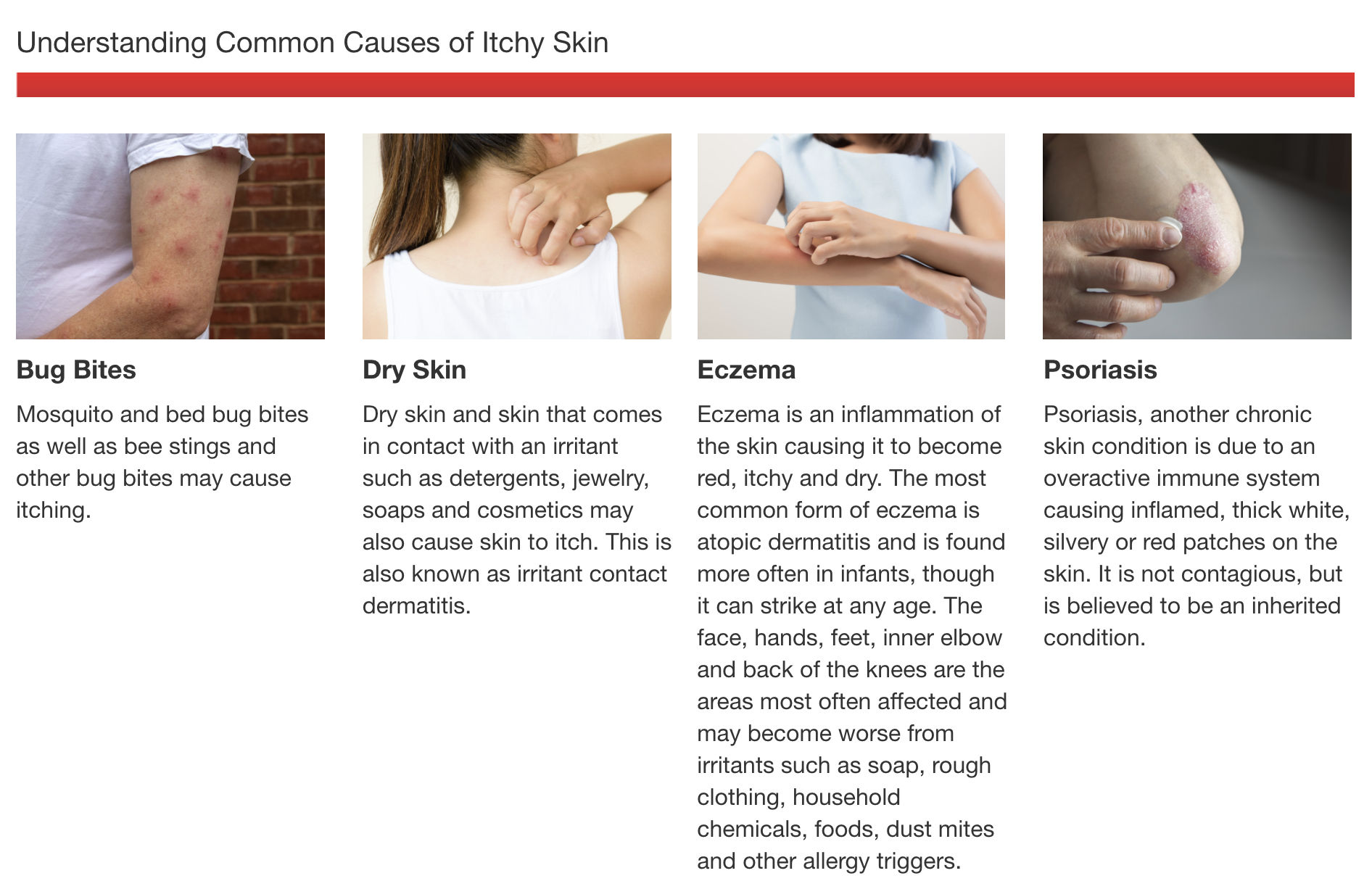 Kem bôi giảm ngứa & dị ứng Kirkland Hydrocortisone 1% Plus