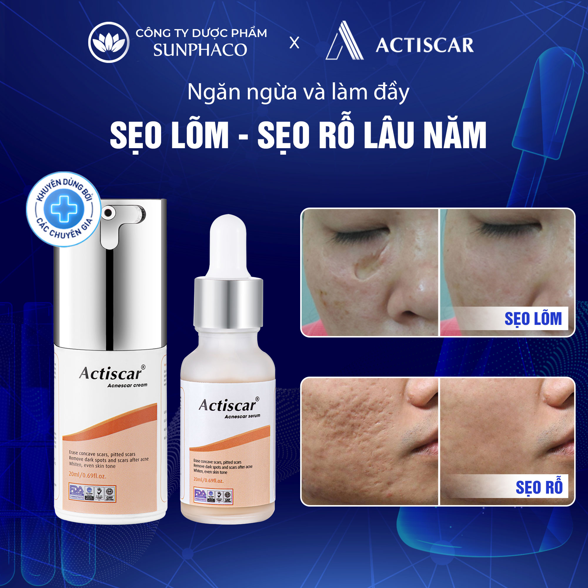 Bộ kem serum sẹo lõm, sẹo rỗ chuyên sâu actiscar làm phẳng và làm mờ sẹo lõm rỗ lâu năm