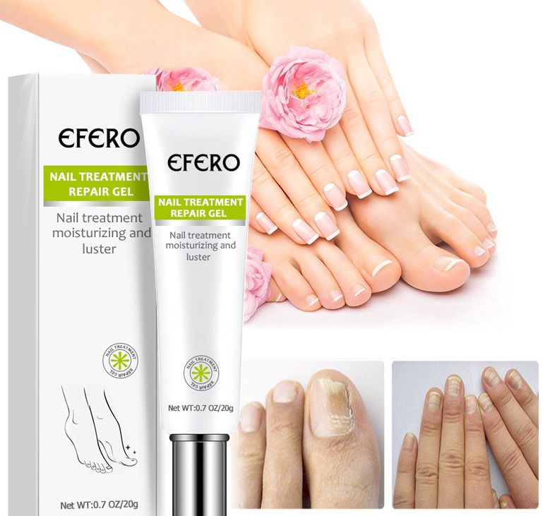 Gel Giúp Cải Thiện Móng Tay Bị Tổn Thương, Lão Hóa, Môi Trường, Phục Hồi Móng Yếu Hư Tổn Trở Lên Bóng Khỏe, Tái Tạo Lại Móng Đem Lại Vẻ Đẹp Hoàn Chỉnh Cho Đôi Bàn Tay Snail Treatment Repair Gel