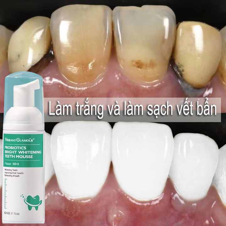 Làm trắng răng, loại bỏ mảng bám, ố vàng, vết khói bám trên răng, ngăn ngừa sâu răng, hôi miệng, chăm sóc răng miệng sạch sâu, cho hơi thở thơm tho