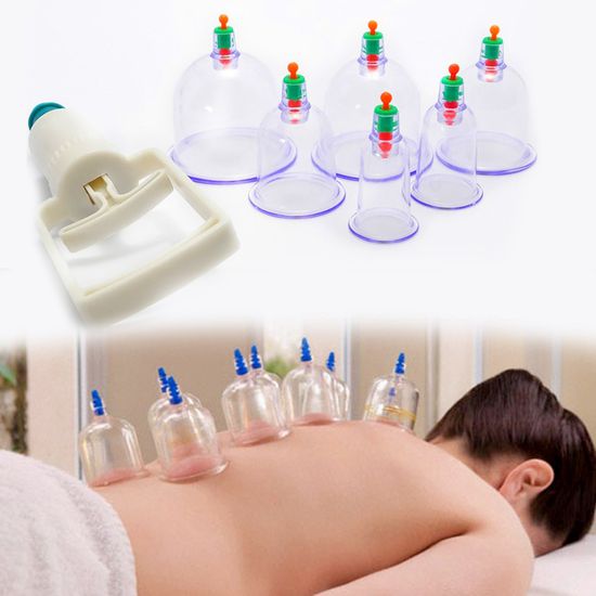 Giao siêu tốc 24h - Bộ giác hơi 12 ống hút chân không, hỗ trợ đau nhức xương khớp, mệt mỏi, đau lưng, đau cơ, giảm stress