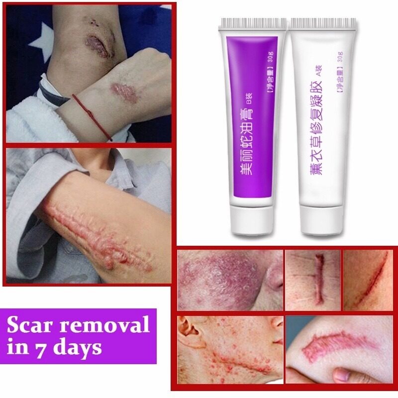  Loại bỏ sẹo Kem dưỡng da rắn Lavender Sửa chữa sẹo Loại bỏ vết rạn da 2 cái  30g+30g  Sửa chữa da Kem trị mụn trứng cá 