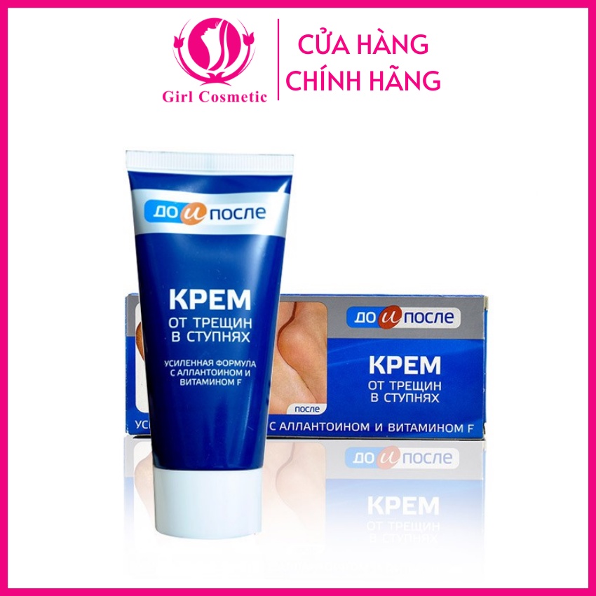 Kem dưỡng gót chân mềm mịn, chống nẻ