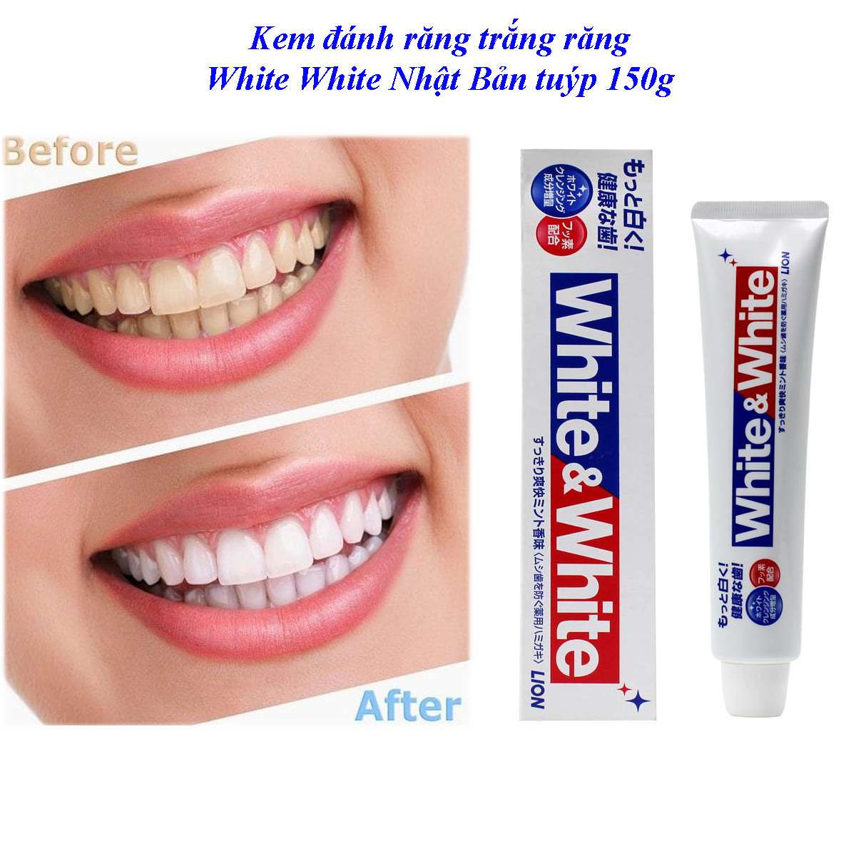 Kem đánh răng trắng răng White White Nhật Bản tuýp 150g