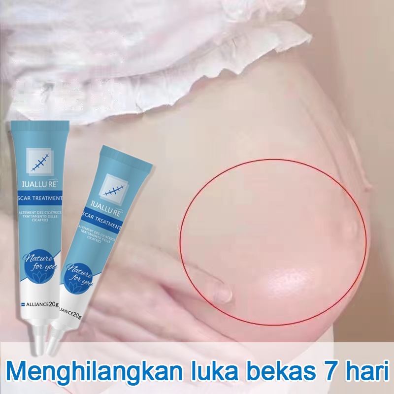 Kem Làm Mờ Rạn Da Làm Mờ Sẹo Cấp Ẩm Giảm Thâm Do Sẹo Mụn Scar Remover Kem làm mờ sẹo chăm sóc sẹo giảm sẹo mụn Phục hồi sẹo rỗ sẹo thâmVết bỏng Làm mờ vết rạn da khi mang thai Loại bỏ sẹo mụn Ngăn ngừa mụn trứng cá mụn đầu đen cho mặt và cơ thể