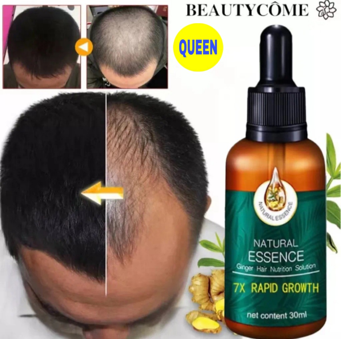 Tinh dầu kích mọc tóc nhanh ngăn ngừa rụng tóc chai tinh dầutinh chất giúp tóc mọc nhanh chống rụng tóc Tinh chất tăng trưởng tóc nhanh Hair Grower Dầu xả tóc Tinh chất ngăn ngừa rụng tóc cho nam và nữ 30ML
