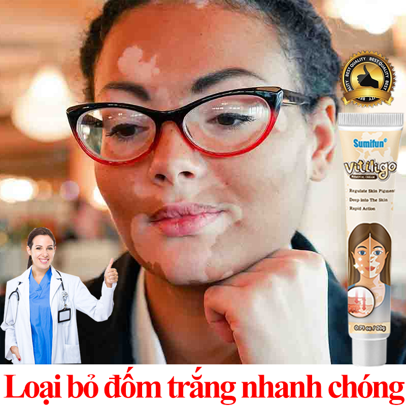 kem trị lang ben trắng 20g Kem bôi bạch biến Trị lang ben bạch biến mặt spot