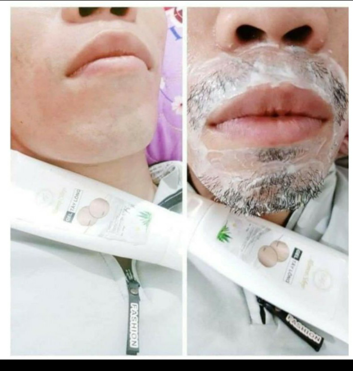 [Mua 1 tặng 1 serum]Kem Tẩy Râu Lông Vĩnh Viễn Mamen Shop(Tẩy râu ria, lông nách, lông BIKINI, chân, tay, ngực, bụng..)tiện lợi chi phí rẻ...Tặng serum ức chế mọc lại