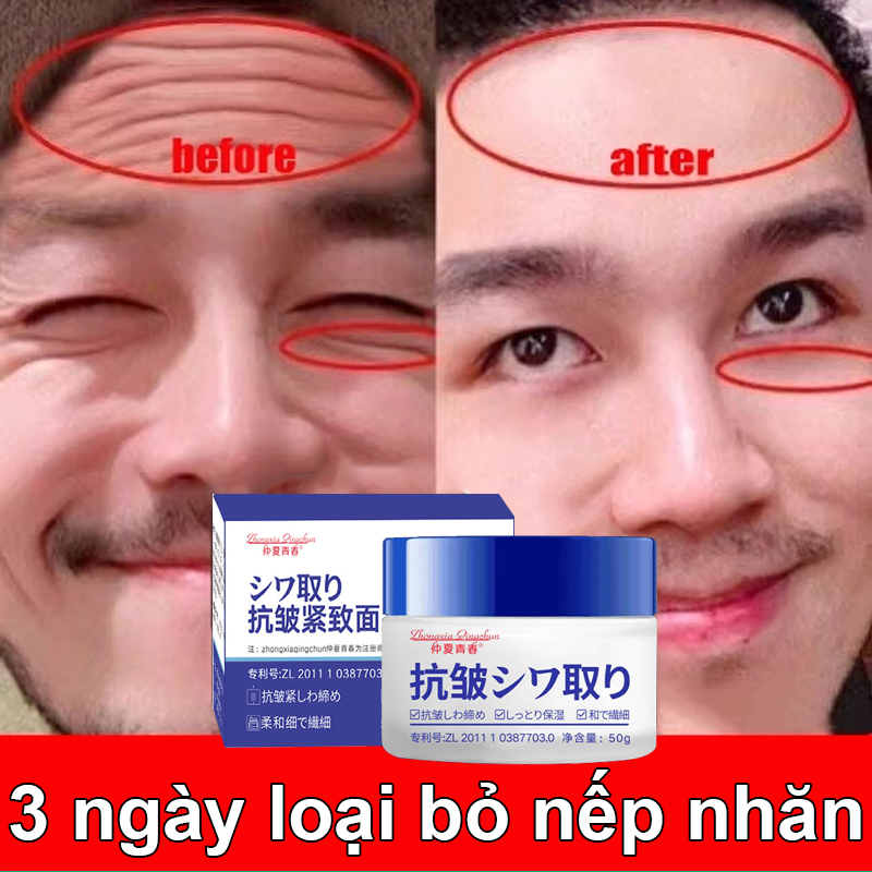 Kem xóa nếp nhăn nhanh chóng chống lão hoá làm trắng da 5 giây loại bỏ nếp nhăn 50g nhanh chóng làm mịn nếp nhăn nâng cơ và săn chắc da mặt làm mịn và dưỡng ẩm se lỗ chân lông thông dụng cho mọi loại da nam và nữ