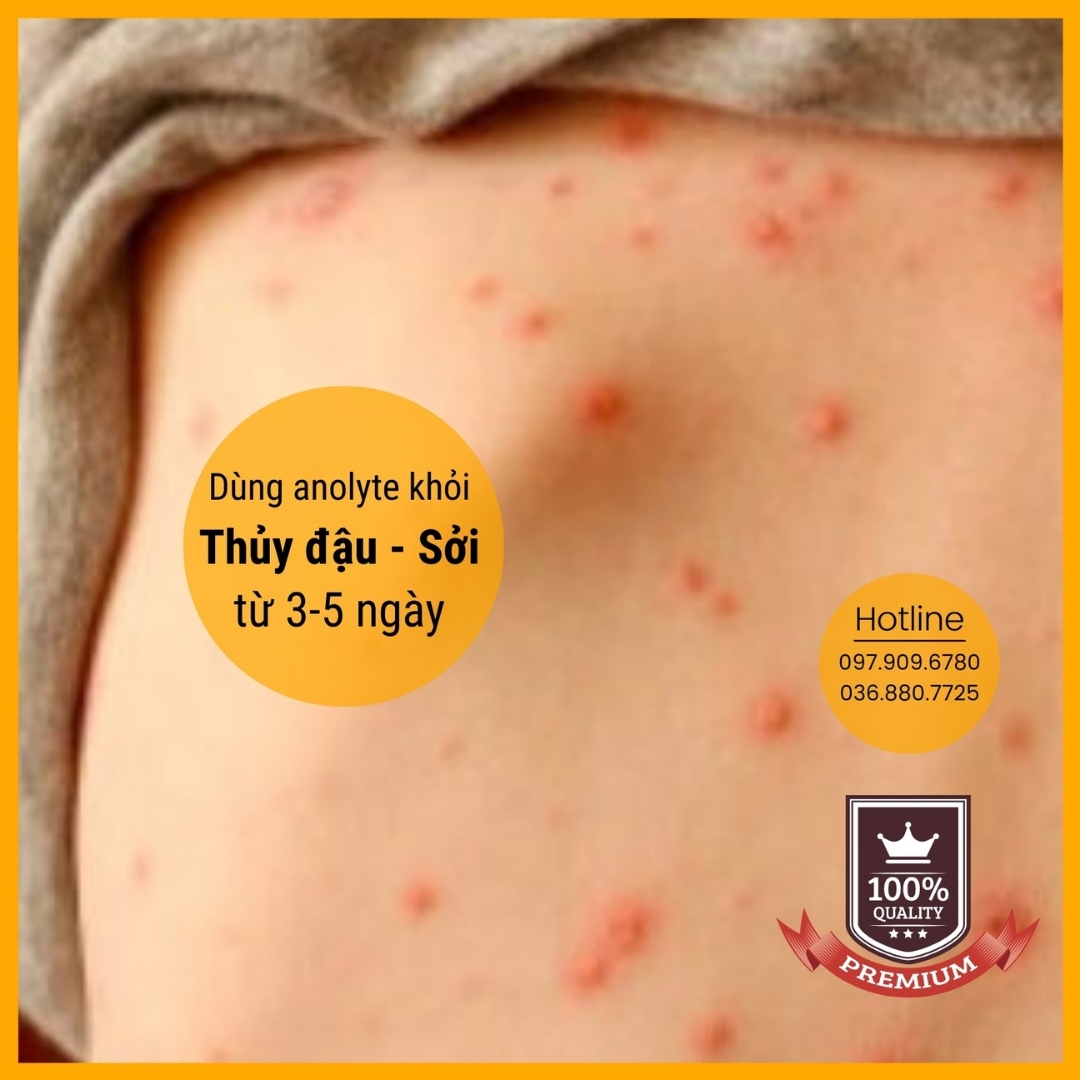 Dung dịch Anolyte KT (Nước A - Combo 3 chai 1,5lit)