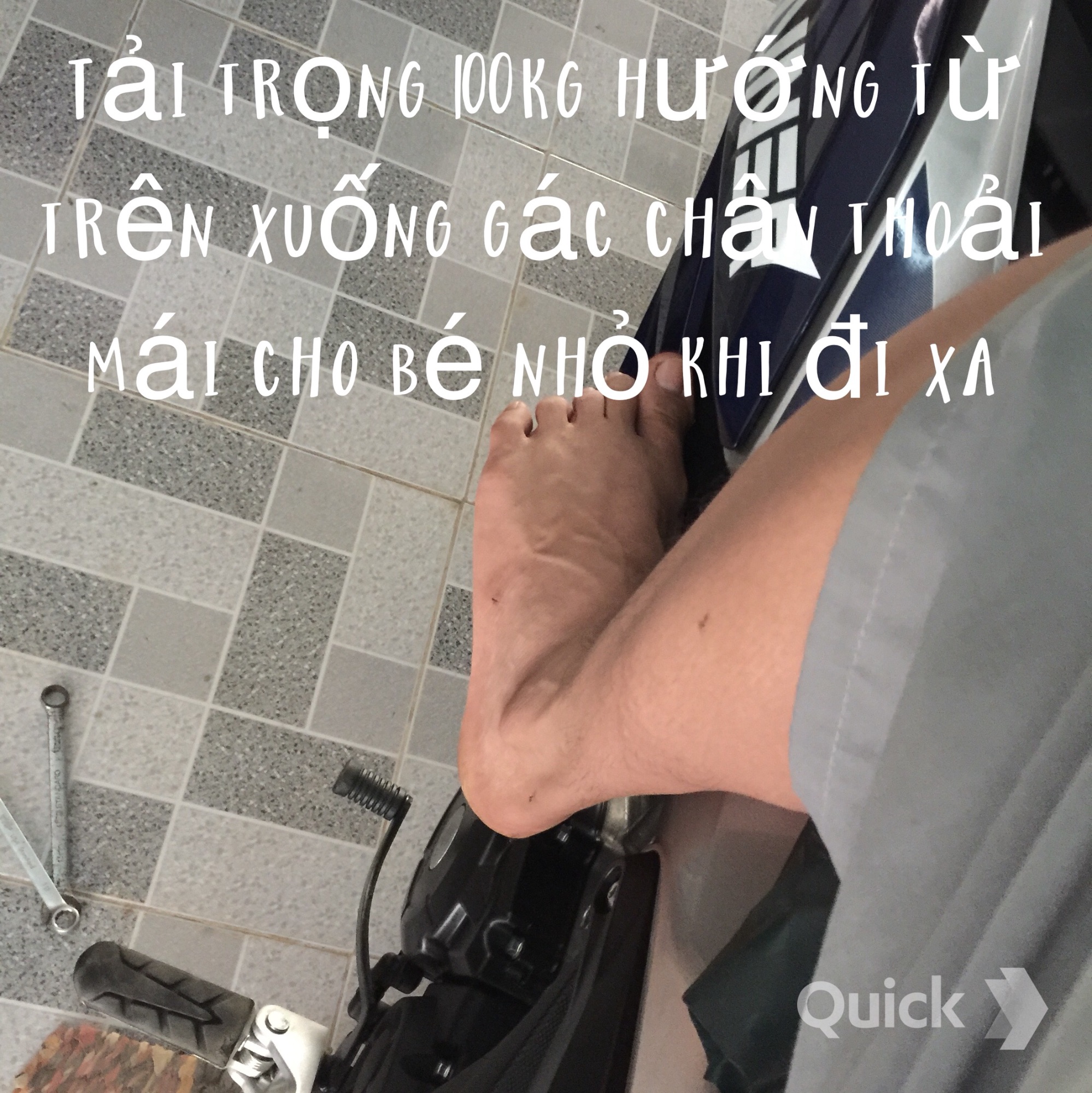 Chống đỗ winner x