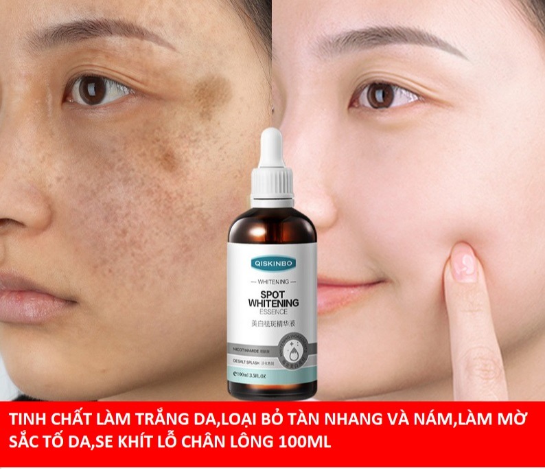Tinh chất làm trắng da,loại bỏ nám,tàn nhang,tái tạo da,thu nhỏ lỗ chân lông SPOT WHITENING ESSENCE SKINBO