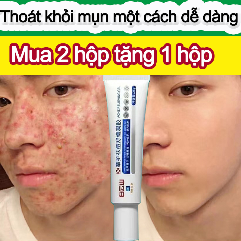 Gel Giảm Mụn Và Thâm 50g kem trị mụn Essence Tuýp kem bôi mụn mẫu mới, giảm mụn, mờ thâm hiệu quả gel dưỡng ẩm dịu nhẹ