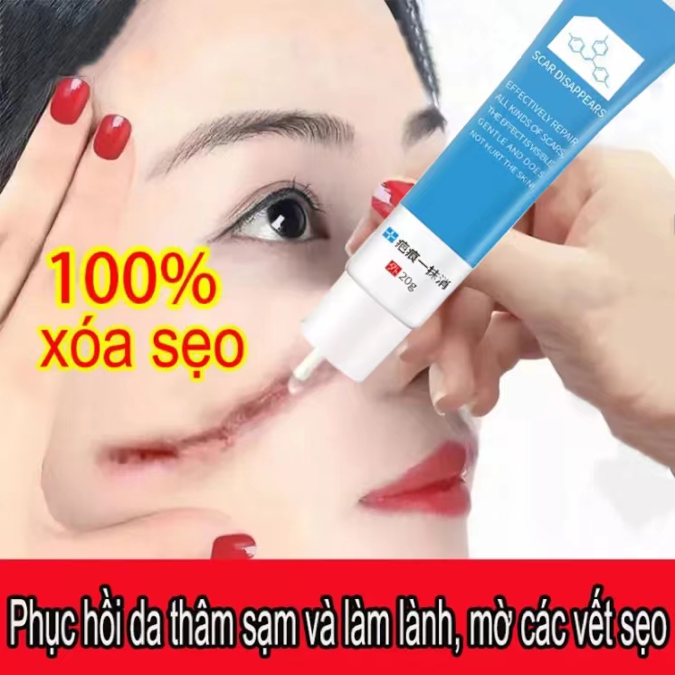 Kem xóa sẹo Loại bỏ Sẹo mụn Vết rạn da và Sẹo lồi Sửa chữa da kem chuyên xóa sẹo lồi lâu nămsẹo bỏngsẹo mụntrầy xước.mờ sẹo thâm mụnmờ thâm khổi phục da