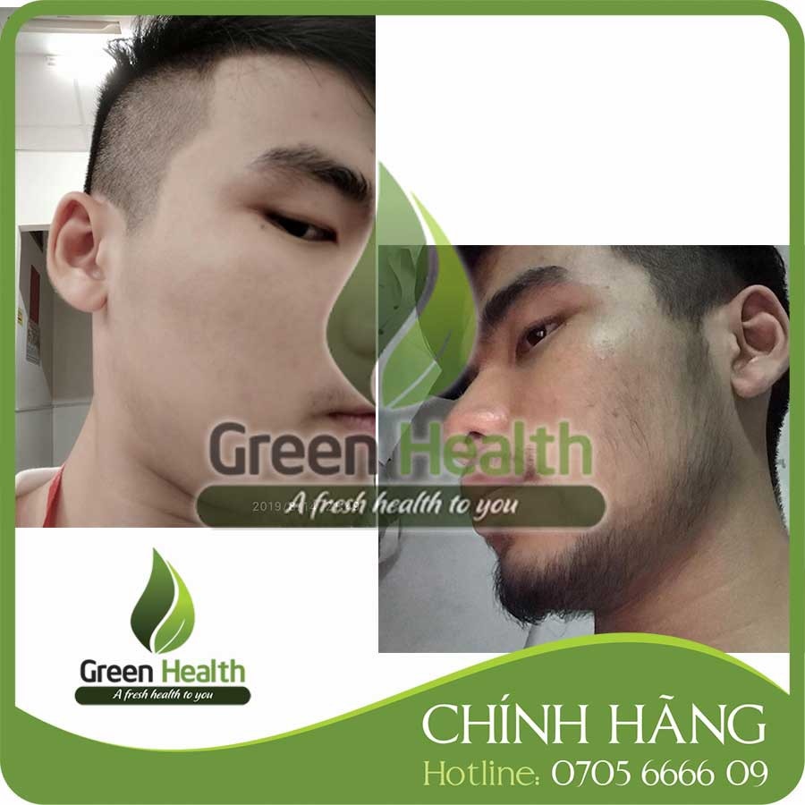 https://vn-live-01.slatic.net/p/1b5c42c678f251d23afc7b1a851885ce.jpg