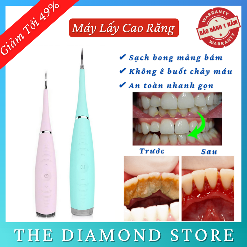 Máy Lấy Cao Răng Tại Nhà Với 3 Chế Độ Vô Cùng An Toàn Và Tiện Lợi - Bảo Hành 12 Tháng