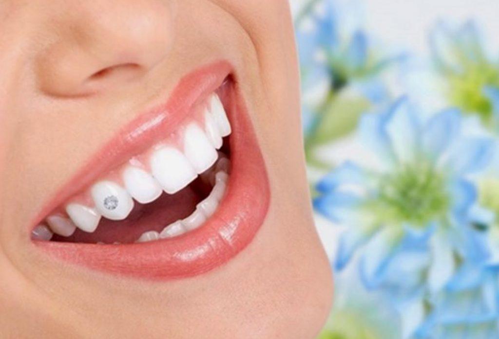 Đá kim cương nhân tạo dán răng đế bằng hạt rời 3.0 ly
