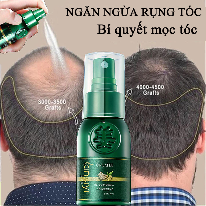 Dung dịch dưỡng chất gừng, chống rụng tóc, chống ngứa, kiểm soát dầu và làm mới [30ml] đẩy nhanh quá trình mọc tóc, loại bỏ bọ chét, ổn định chân tóc, các chiết xuất từ thực vật mềm mượt dễ hấp thụ hơn