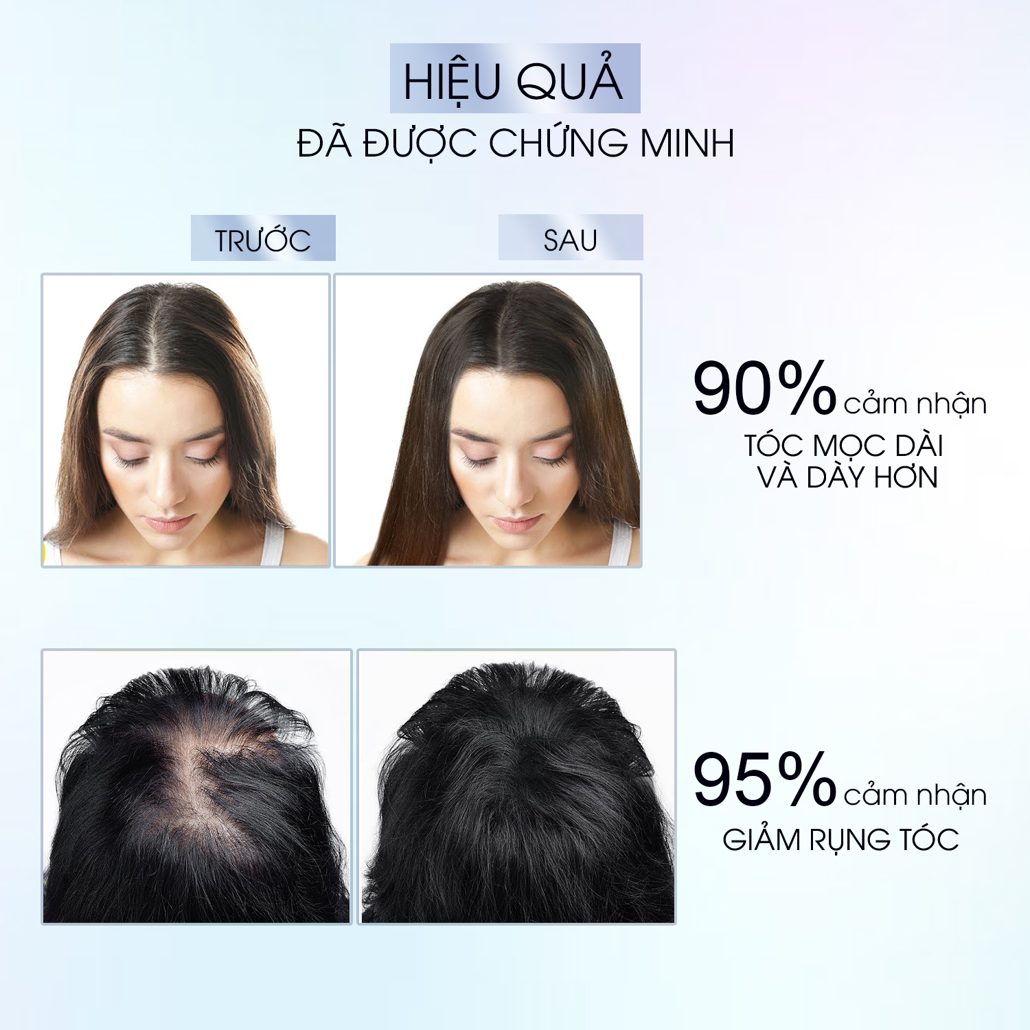 FEG Hair Growth Spray - Xịt Dưỡng Kích Thích Mọc Tóc FEG Giúp Tóc Dày và Dài Sau 14 Ngày