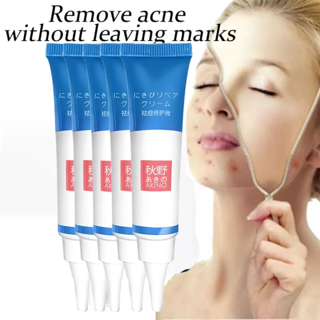 Kem mụn，Kem chấm mụn thâm cấp tốc cho nam giới nữ giới,gel mụn ，Kem Hết Mụn, Xóa thâm- Gel giảm mụn giảm thâm 12g