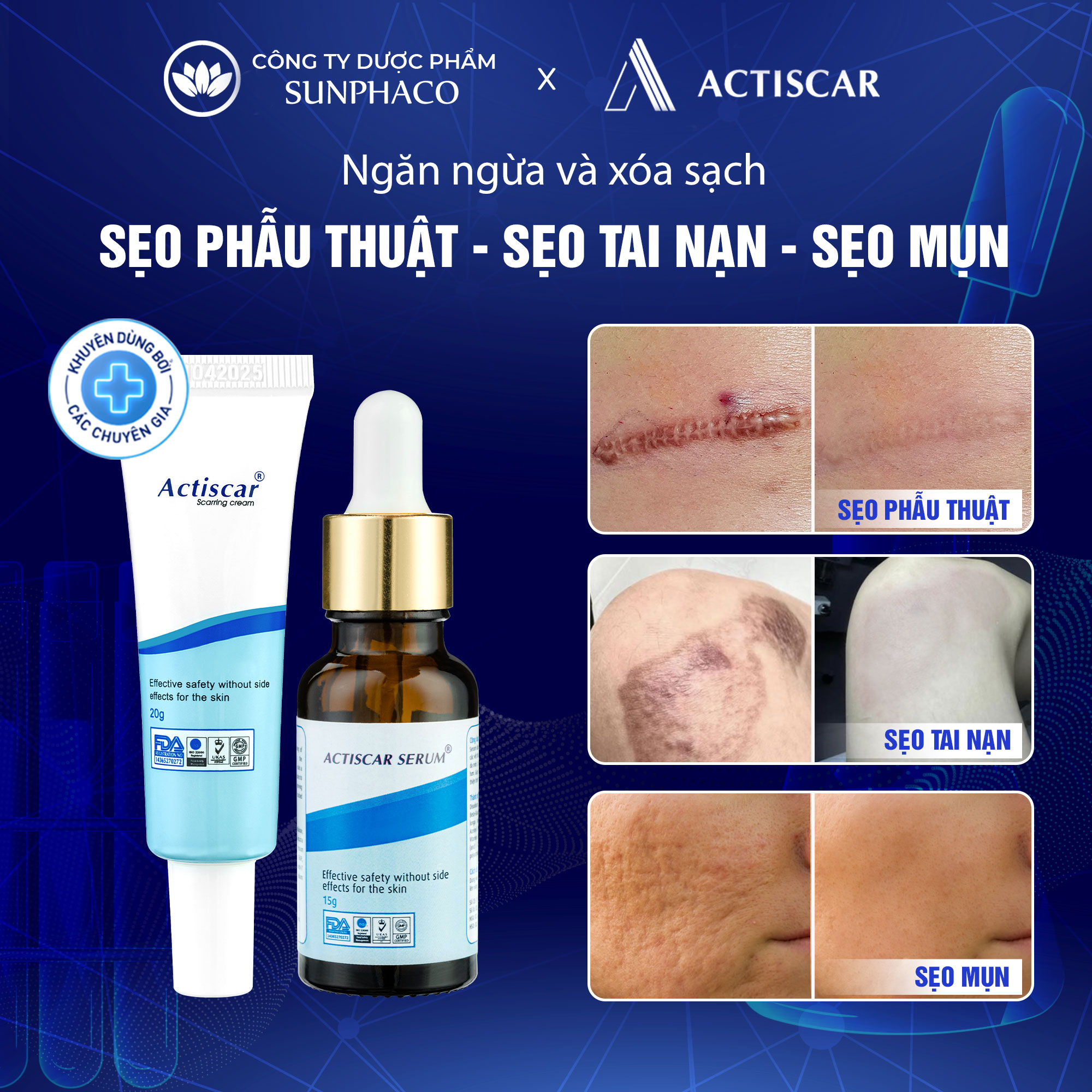 Combo xoá mờ sẹo actiscar làm mờ sẹo lồi, sẹo lõm, sẹo rỗ, sẹo thâm