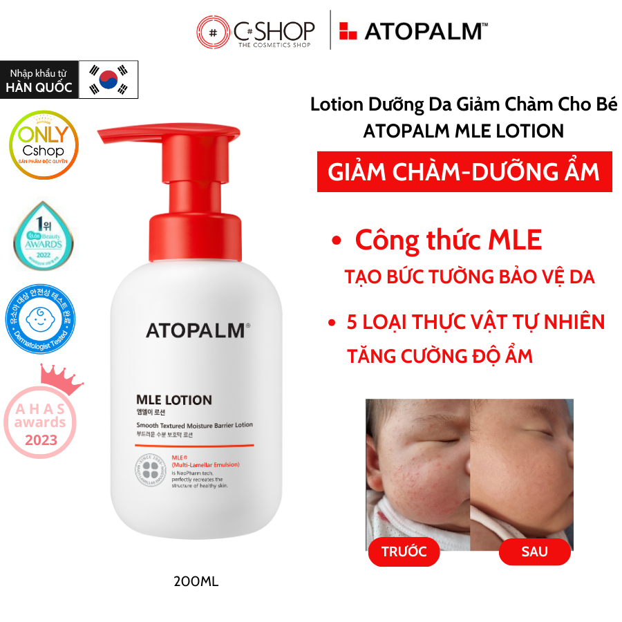 Sữa dưỡng thể cho bé Atopalm MLE Lotion 200ml