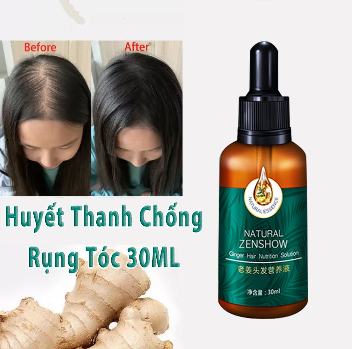 Dầu dưỡng tóc tinh dầu chăm sóc tóc Tinh chất mọc tóc Tinh chất gừng tươi Chống rụng tóc 30ml nước dinh dưỡng tóc gừng