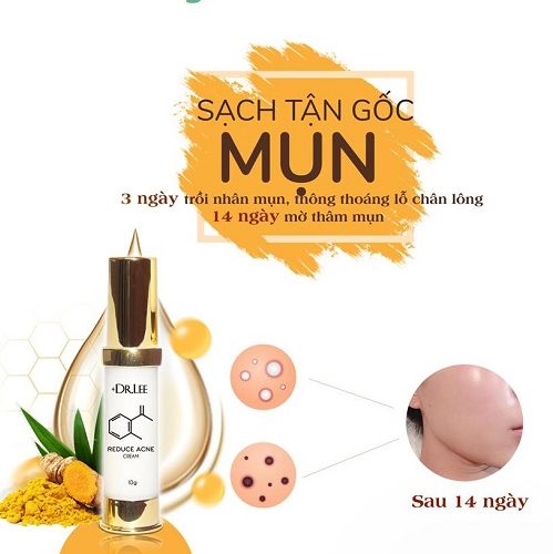 Kem mụn mờ thâm +Dr.Lee Hàn Quốc, khô mụn sau 3 ngày, sạch mụn mờ thâm sau 14 ngày sử dụng
