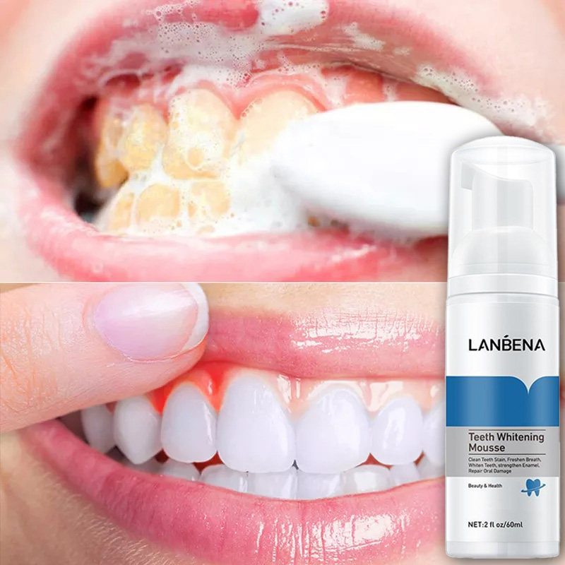 LANBENA Mousse trắng răng Làm sạch răng Làm trắng răng Teeth Whitening Mousse