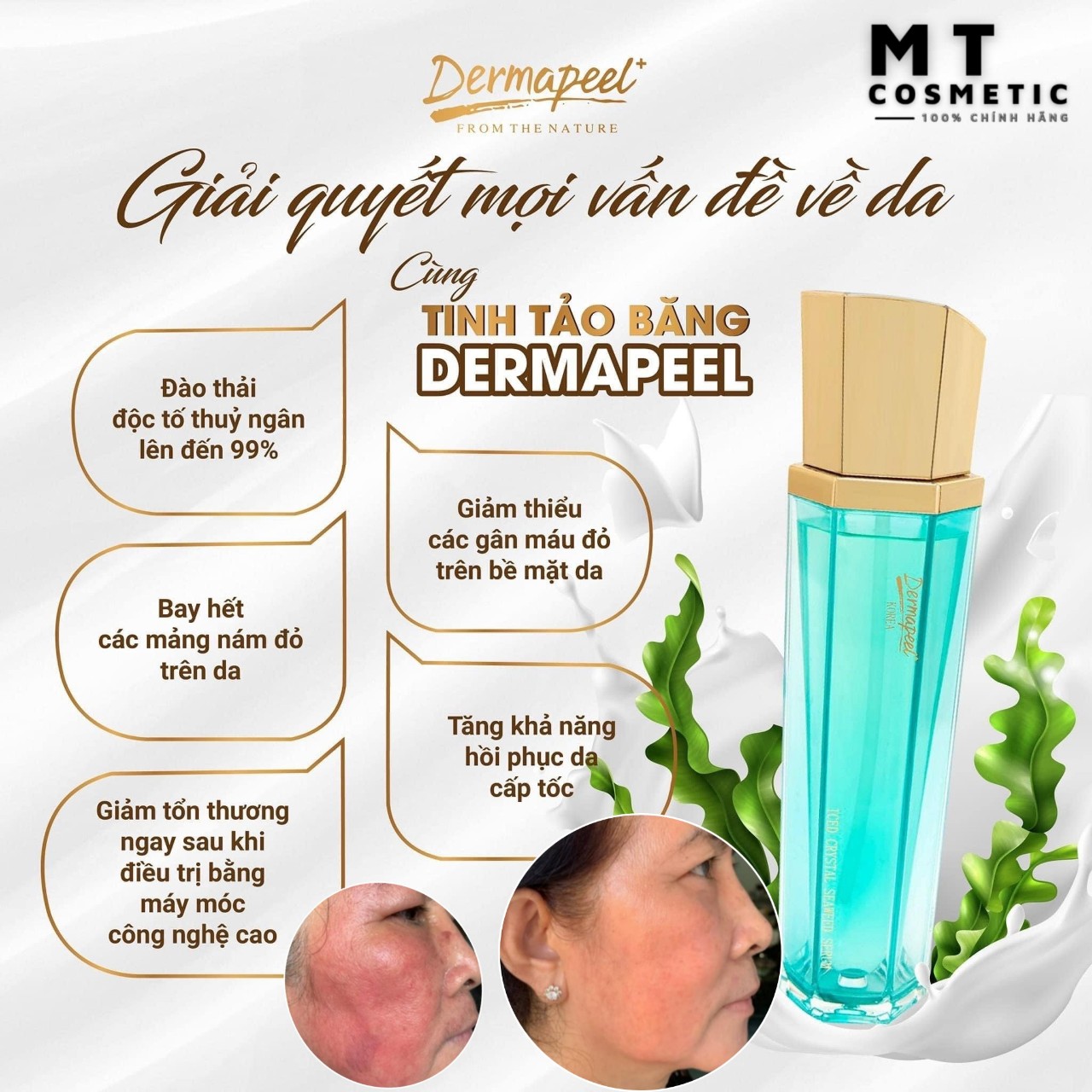 SERUM DERMAPEEL TINH TẢO BĂNG - ICED CRYSTAL SEAWEED SERUM DERMAPEEL - GIẢM TÌNH TRẠNG DA SƯNG ĐỎ NHANH CHÓNG - PHỤC HỒI DA HƯ TỔN - TRẮNG SÁNG - NÂNG CƠ DA