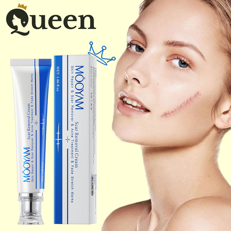 Kem xóa sẹo thâm MOOYAM Scar removing cream 30g Sẹo lồi/ sẹo lõi/ sẹo thâm/ sẹo rỗ/ sẹo phì đại