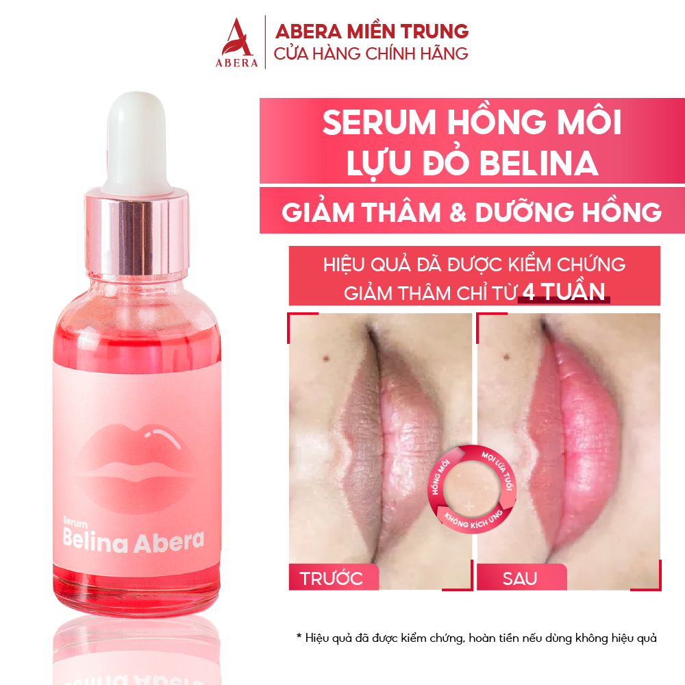 Serum khử thâm môi giúp hồng môi Belina Abera 20ml - Dưỡng môi hồng căng bóng tự nhiên, giảm thâm môi, khô môi nứt nẻ nhanh chóng, tẩy da chết môi