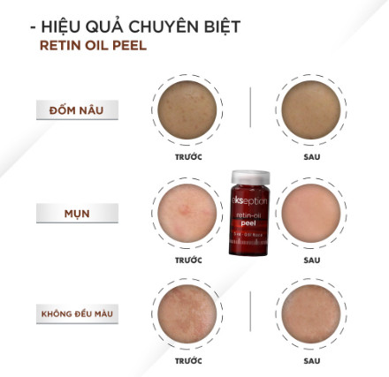 Tinh chất Peel da Ekseption Retin-oil 5ml