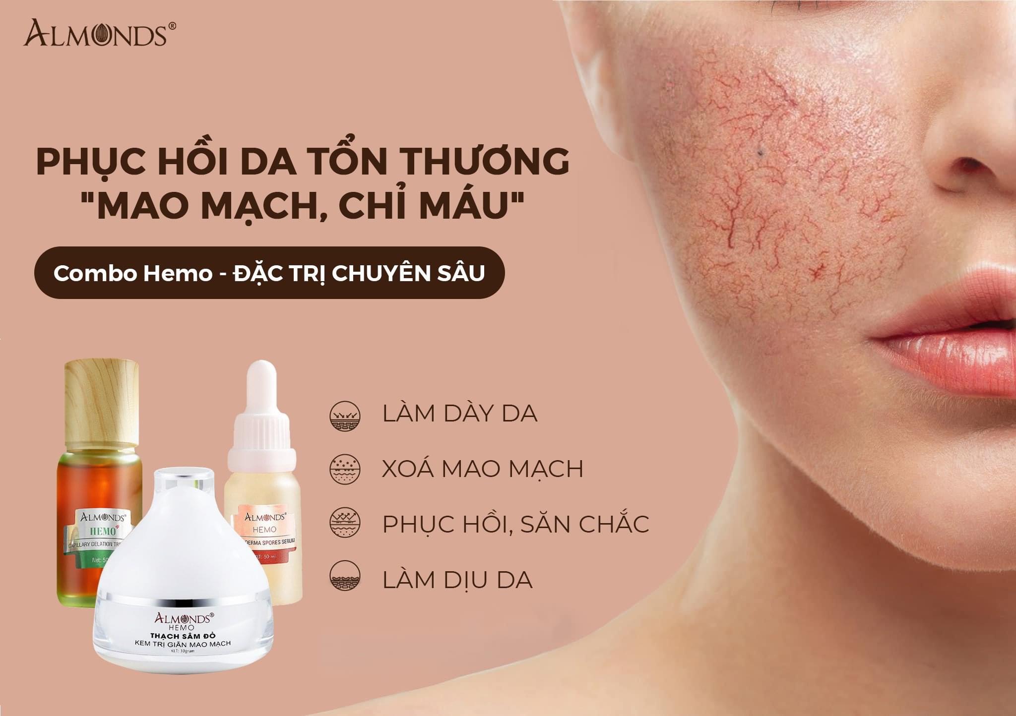 [HCM]Xóa bỏ nổi lo GIÃN MAO MẠCH Ở MẶT NÁM MÁU