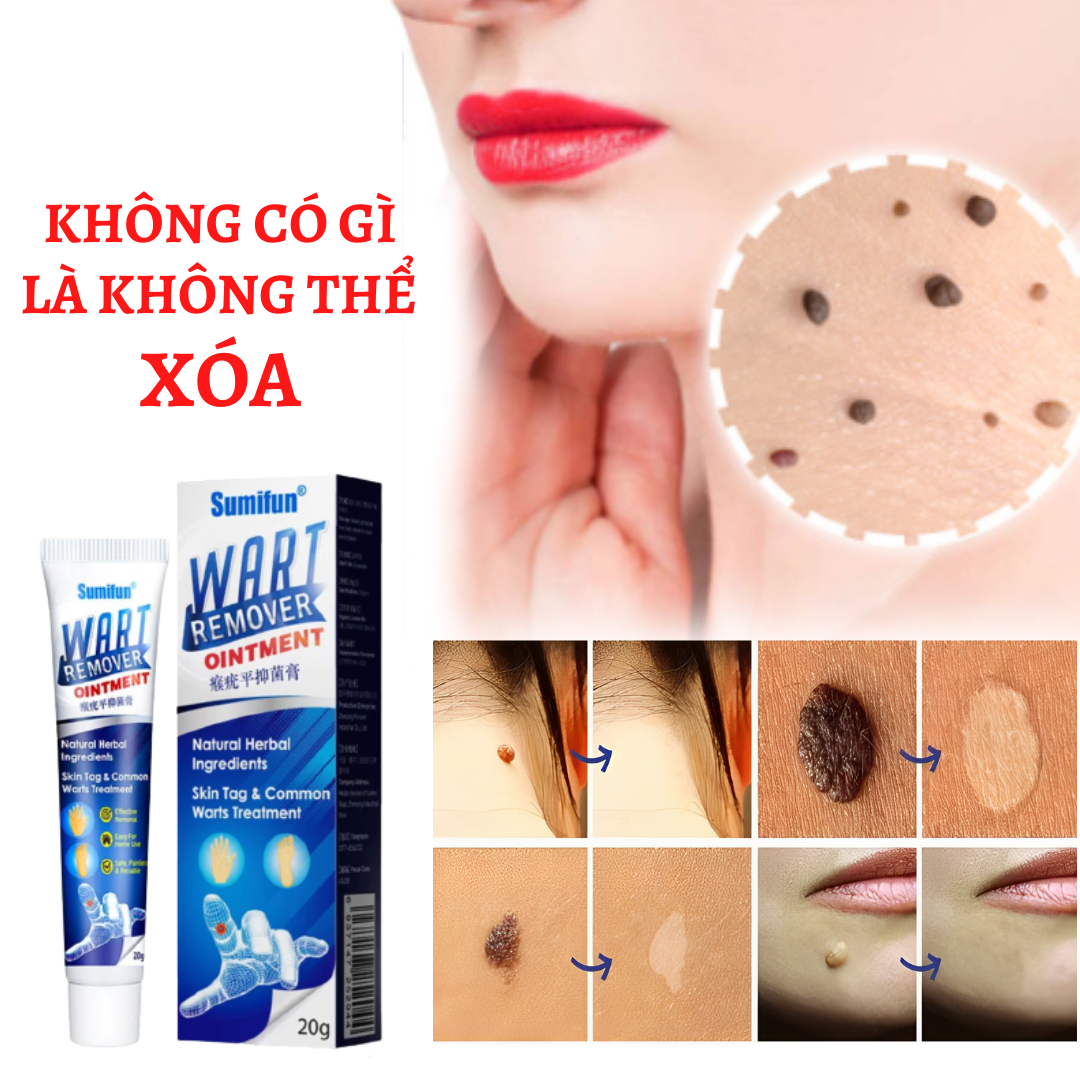 Đánh bật mụn cóc,mụn thịt,mụn cơm cứng đầu lâu năm hiệu quả hàng chính hãng usa