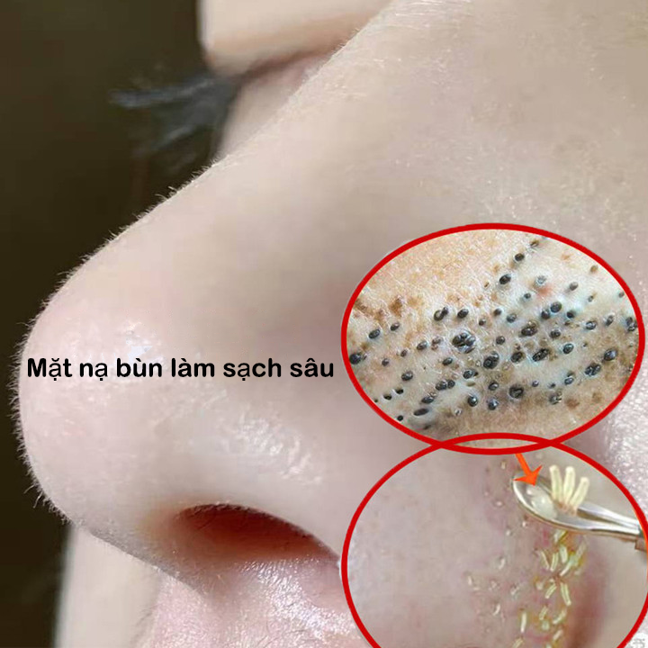 Mặt nạ bùn 100 g Mặt nạ dưỡng trắng Mặt nạ bùn làm sạch sâu Loại bỏ mụn Không còn mụn đầu đen Lỗ chân lông nhỏ lại